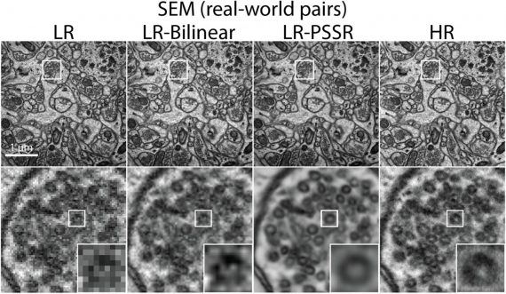 Super resolution used for medical imagery purposes.